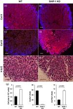 Collagen X Antibody in Immunohistochemistry (IHC)