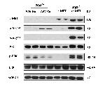 c-Met Antibody in Western Blot (WB)