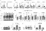 HSD17B1 Antibody in Western Blot (WB)