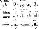 HSD17B1 Antibody in Western Blot (WB)