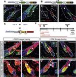 Blimp-1 Antibody in Immunohistochemistry (IHC)