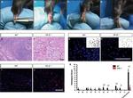 Estrogen Receptor beta Antibody in Immunohistochemistry (IHC)