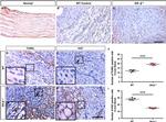 Estrogen Receptor beta Antibody in Immunohistochemistry (IHC)