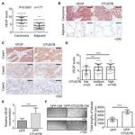 VEGF Antibody in Immunohistochemistry (IHC)