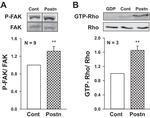 FAK Antibody in Western Blot (WB)