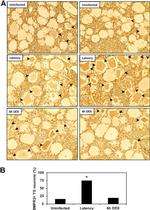 BMPR2 Antibody in Immunohistochemistry (IHC)