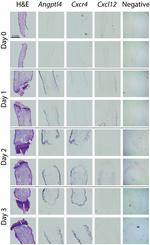 ANGPTL4 Antibody in Immunohistochemistry (IHC)