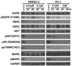 Phospho-EGFR (Tyr1086) Antibody in Western Blot (WB)