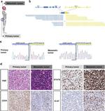 CD34 Antibody in Immunohistochemistry (IHC)