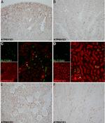 V-ATPase E1 Antibody in Immunocytochemistry, Immunohistochemistry (ICC/IF, IHC)