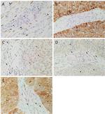 SOX2 Antibody in Immunohistochemistry (IHC)