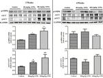 Acetyl-CoA Carboxylase Antibody in Western Blot (WB)