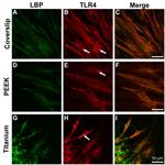 LBP Antibody in Immunocytochemistry (ICC/IF)