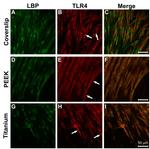 LBP Antibody in Immunocytochemistry (ICC/IF)