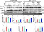 Phospho-CaMKII beta/gamma/delta (Thr287) Antibody in Western Blot (WB)