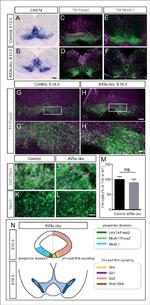 PITX3 Antibody in Immunohistochemistry (IHC)