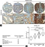 SPARC Antibody in Immunohistochemistry (IHC)