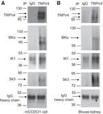 KCNN4 Antibody in Western Blot (WB)