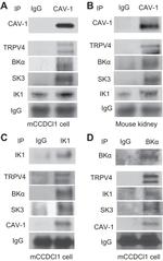 KCNN4 Antibody in Western Blot (WB)