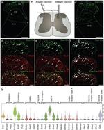 EBF2 Antibody in Immunohistochemistry (IHC)