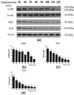 Calcium Sensing Receptor Antibody in Western Blot (WB)