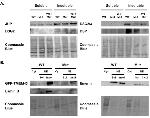 gamma Catenin Antibody in Western Blot (WB)