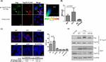 TSG101 Antibody in Western Blot, Immunoprecipitation (WB, IP)