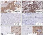 Osteopontin Antibody in Immunohistochemistry (IHC)