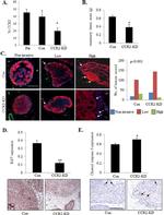 Cytokeratin 5 Antibody in Immunohistochemistry (IHC)