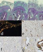 Calprotectin Antibody in Immunohistochemistry (IHC)