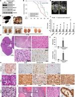 Carbonic Anhydrase IX Antibody in Immunohistochemistry (IHC)