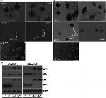 Estrogen Receptor alpha Antibody in Western Blot (WB)