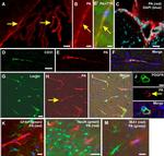 Transthyretin Antibody in Immunohistochemistry (IHC)