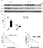 NMDAR2B Antibody in Western Blot (WB)