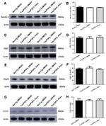 LC3A/LC3B Antibody in Western Blot (WB)