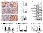 EphA2 Antibody in Immunohistochemistry (IHC)