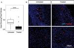 FOXO3A Antibody in Immunohistochemistry (IHC)