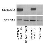 SERCA2 ATPase Antibody in Western Blot (WB)