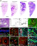 CD31 Antibody in Immunohistochemistry (IHC)