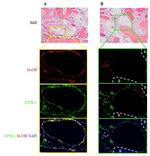 LYVE1 Antibody in Immunohistochemistry (IHC)