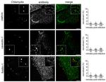 Clathrin Heavy Chain Antibody in Immunocytochemistry (ICC/IF)