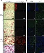 AEBP1 Antibody in Immunohistochemistry (IHC)