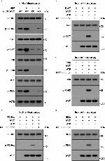 c-Met Antibody in Western Blot (WB)