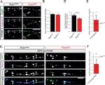 Rabex-5 Antibody in Immunocytochemistry (ICC/IF)