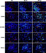 MYOD Antibody in Immunocytochemistry, Immunohistochemistry (ICC/IF, IHC)