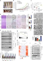 TFEB Antibody in Immunohistochemistry (IHC)