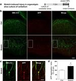 beta Amyloid Antibody in Immunohistochemistry (IHC)