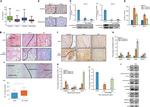 CD44std Antibody in Immunohistochemistry (Paraffin) (IHC (P))