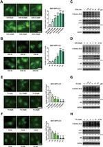 O-linked N-acetylglucosamine (O-GlcNAc) Antibody in Western Blot (WB)