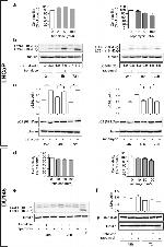 SQSTM1 Antibody in Western Blot (WB)